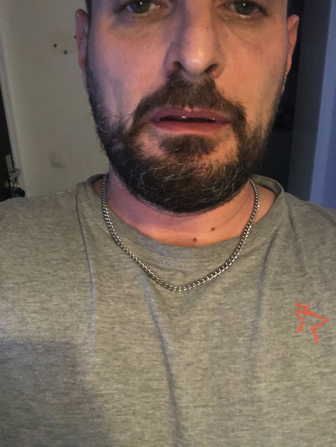 Customer photo review of 18K Gold Rope Chain (3mm - 8mm)