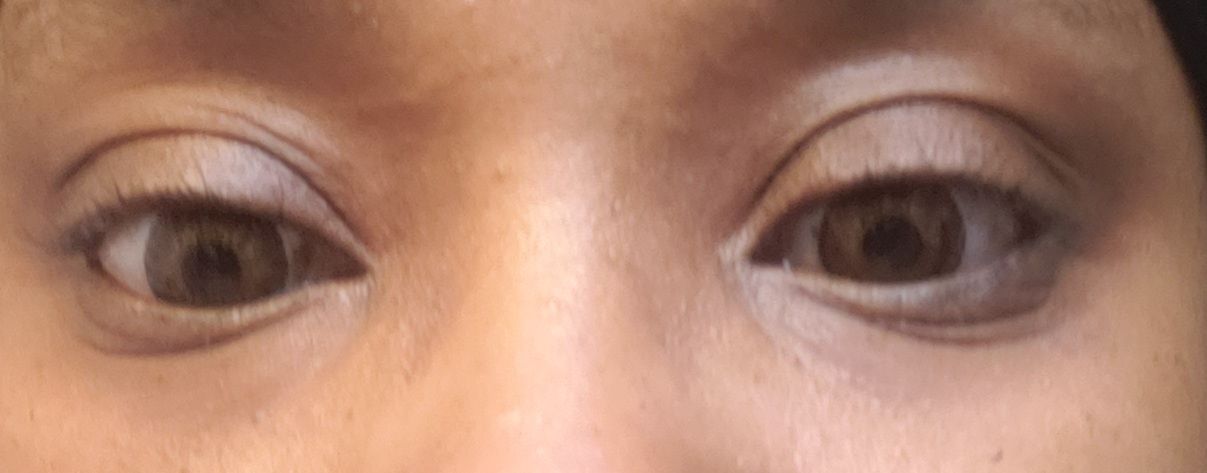 Customer photo review of New 3-Tone Hazel Brown Prescription Colored Contact Lenses