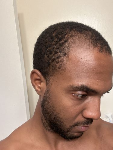 Customer photo review of Eden - Total Hair Wealth Bundle