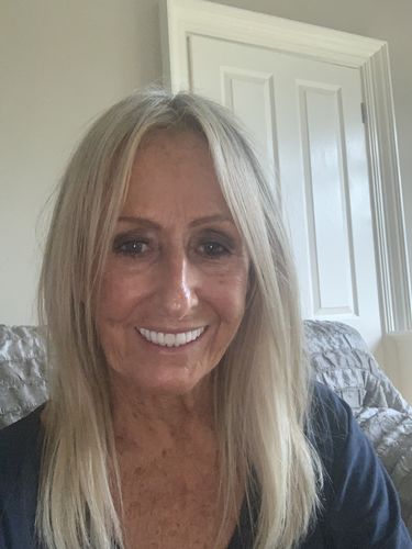 Customer photo review of Invisible Wire Human Hair Extension - Platinum Blonde Balayage