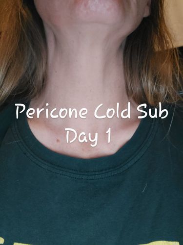 Customer photo review of Cold Plasma Sub-D - 1 fl oz