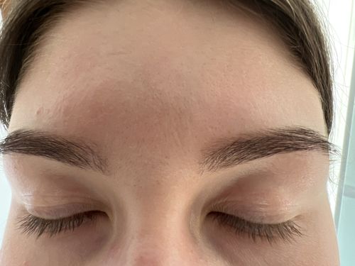 Customer photo review of Wimpern & Augenbrauen Serum