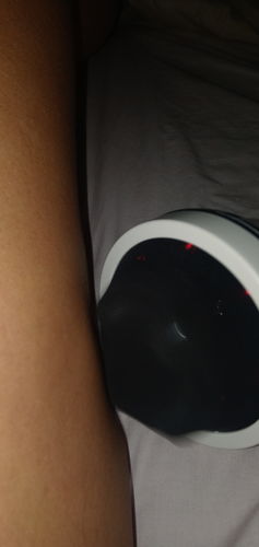 Customer photo review of Masajeador Corporal Anti-celulitis ™