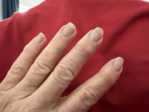 Customer photo review of Rocket Nail Fuel Starter Kit