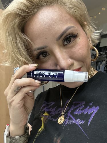 Customer photo review of Scar Gel