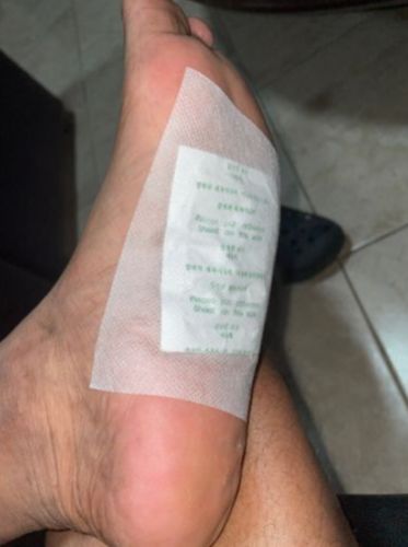 Customer photo review of DetoxCare® | Detox foot patches