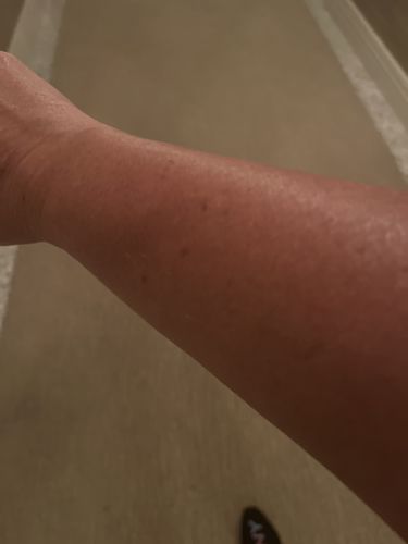 Customer photo review of 100% Natural & Organic Tanning Oil