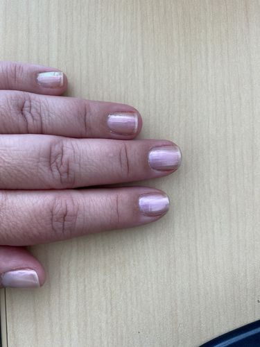 Customer photo review of The Nail System