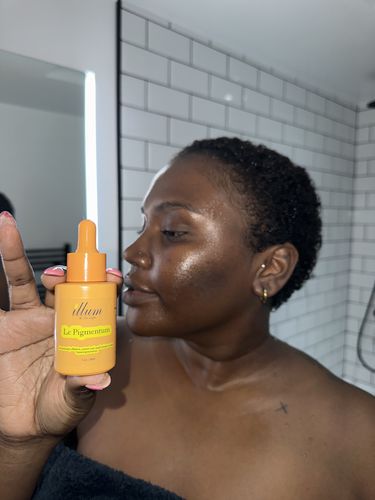 Customer photo review of Le Pigmentum - Hyperpigmentation Treatment