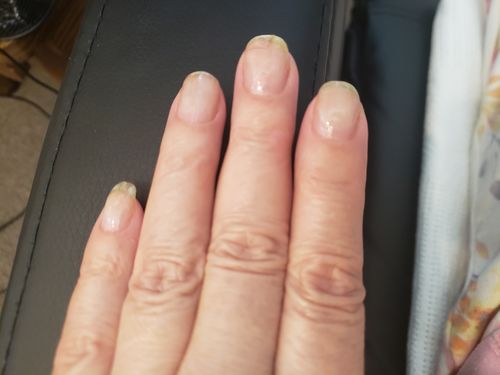 Customer photo review of Rocket Nail Fuel Nail Repair - Clear