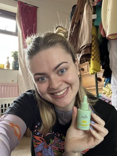 Customer photo review of illum Acno Face Oil - For Acne