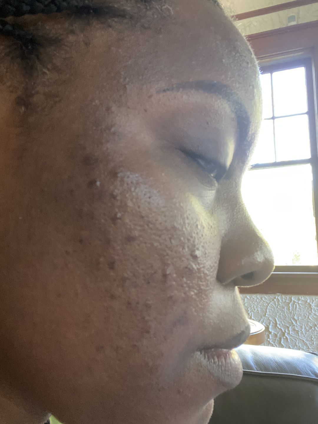 Customer photo review of DAILY C ANTIOXIDANT SERUM