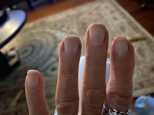 Customer photo review of The Nail System