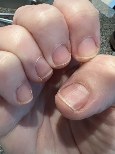 Customer photo review of Rocket Nail Fuel Nail Repair - Clear