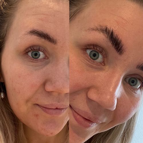 Customer photo review of Brow Lamination Kit
