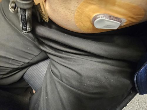 Customer photo review of Skin Grip MAX Dexcom G6 Patches