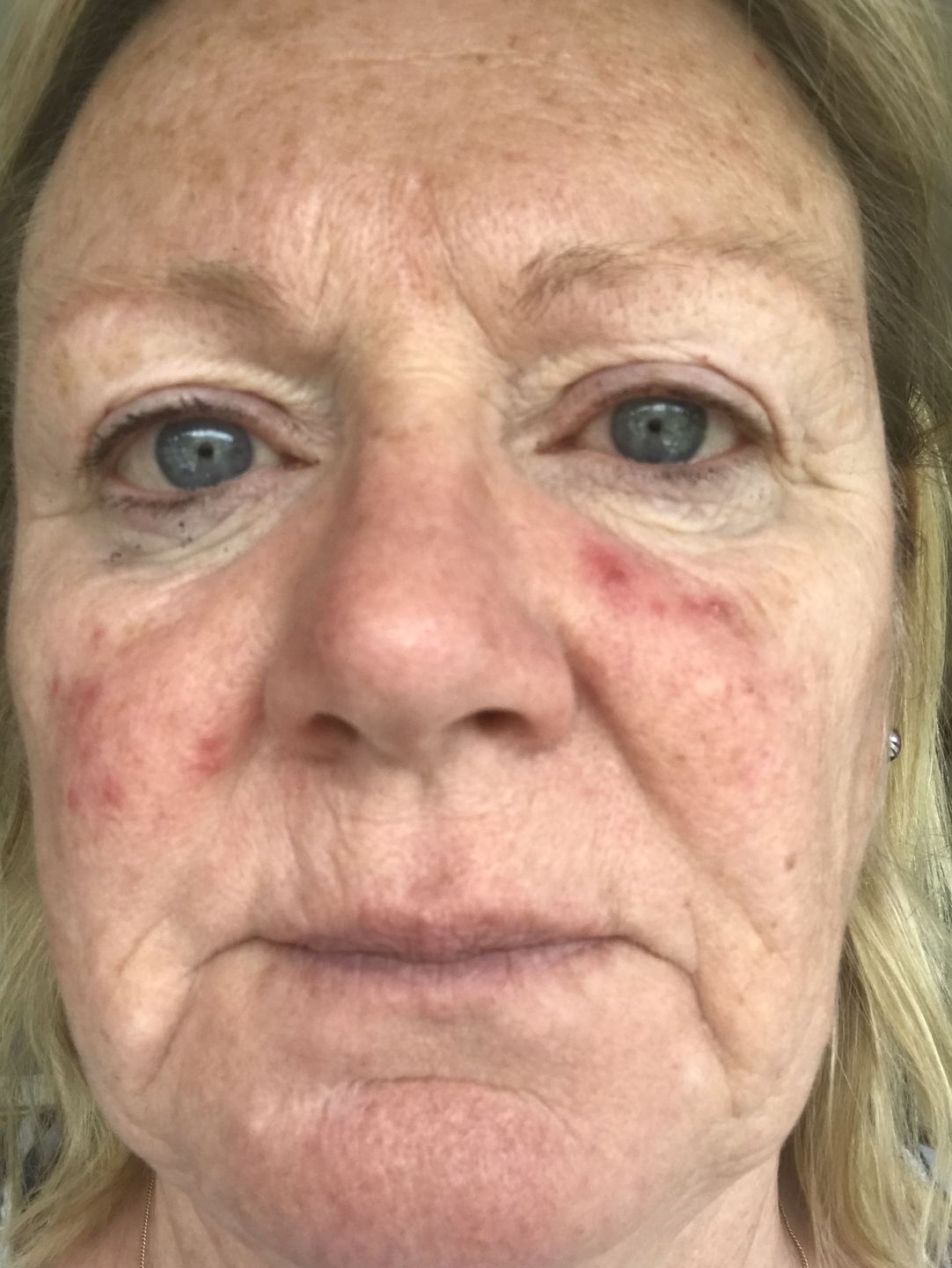 Customer photo review of Repair & Healing Set