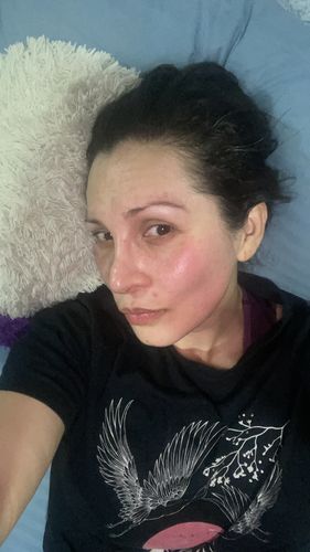 Customer photo review of KIT SERUM FACIAL DIA Y SERUM FACIAL NOCHE CON CELULAS MADRE VEGETALES ❄️