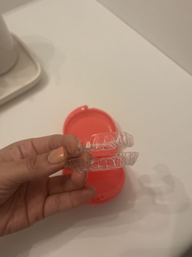 Customer photo review of Upper and Lower Retainers Set