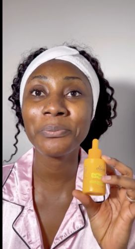 Customer photo review of Le Pigmentum - Hyperpigmentation Treatment