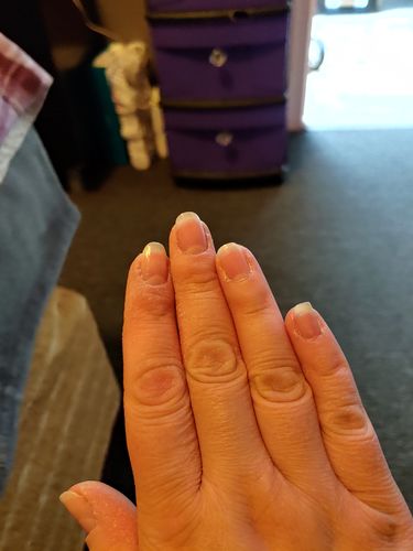 Customer photo review of The Nail System