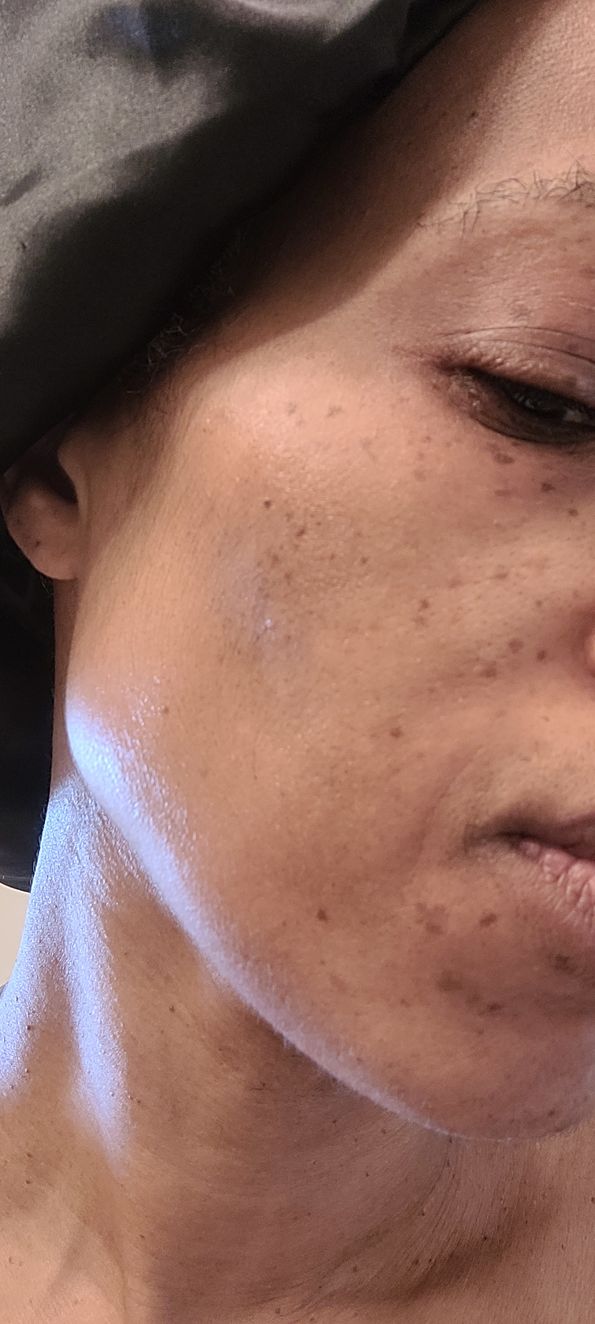 Customer photo review of Magix Cream