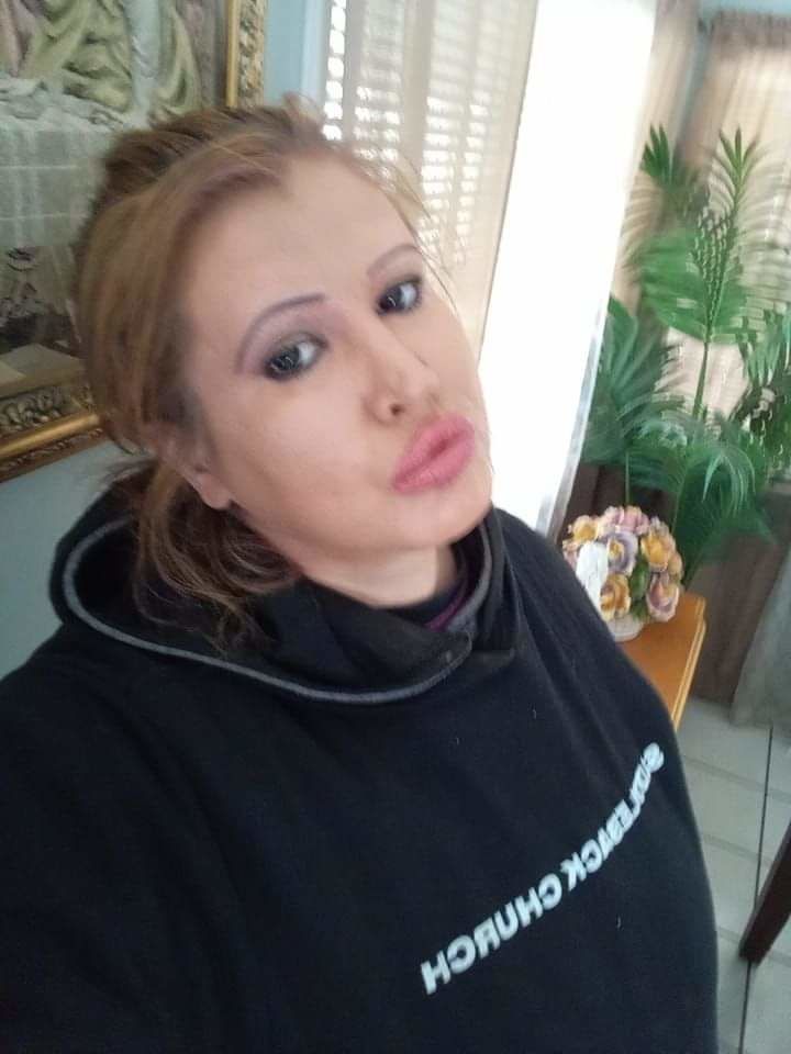 Customer photo review of Amazonia Devil's Triangle Black Prescription Colored Contact Lenses