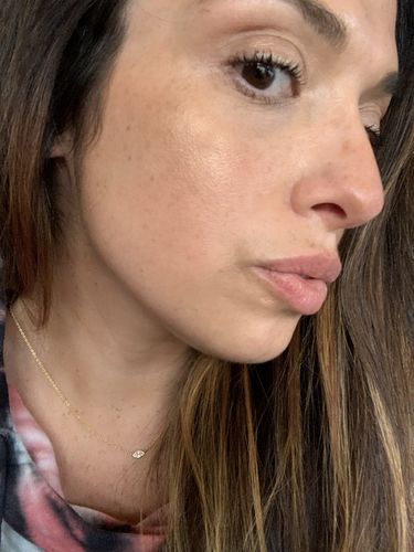 Customer photo review of CheekFix: Filler
