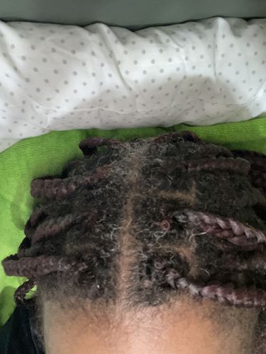 Customer photo review of Hair Recovery Bundle