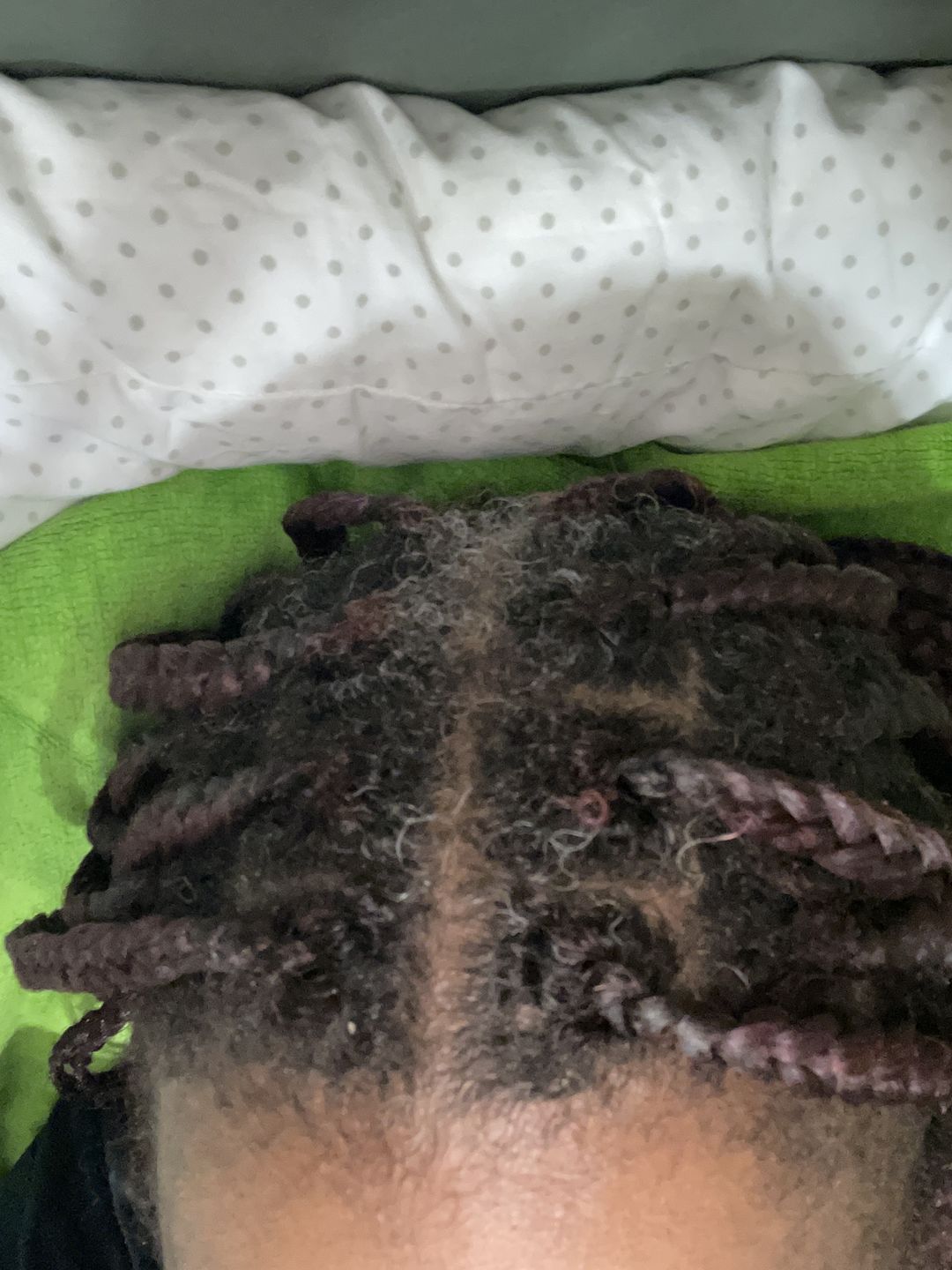 Customer photo review of Hair Recovery Bundle