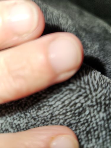 Customer photo review of The Nail System