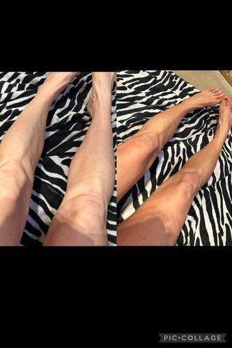 Customer photo review of Desert Bronze Self Tanning Mousse