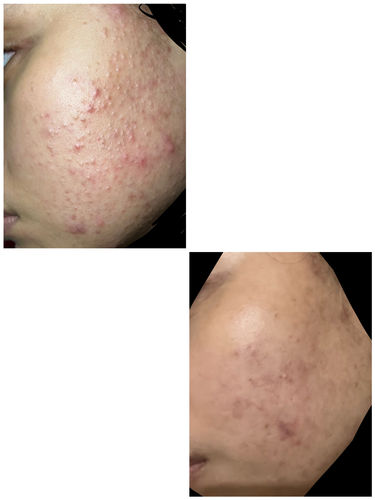 Customer photo review of Brightening Face Creme