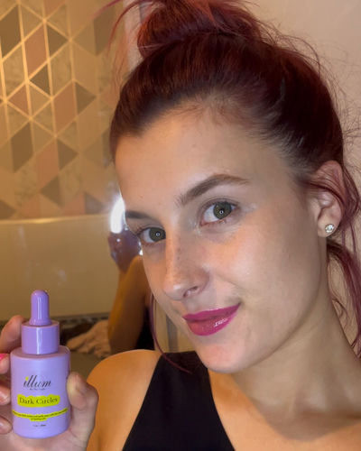 Customer photo review of Dark Circles Treatment