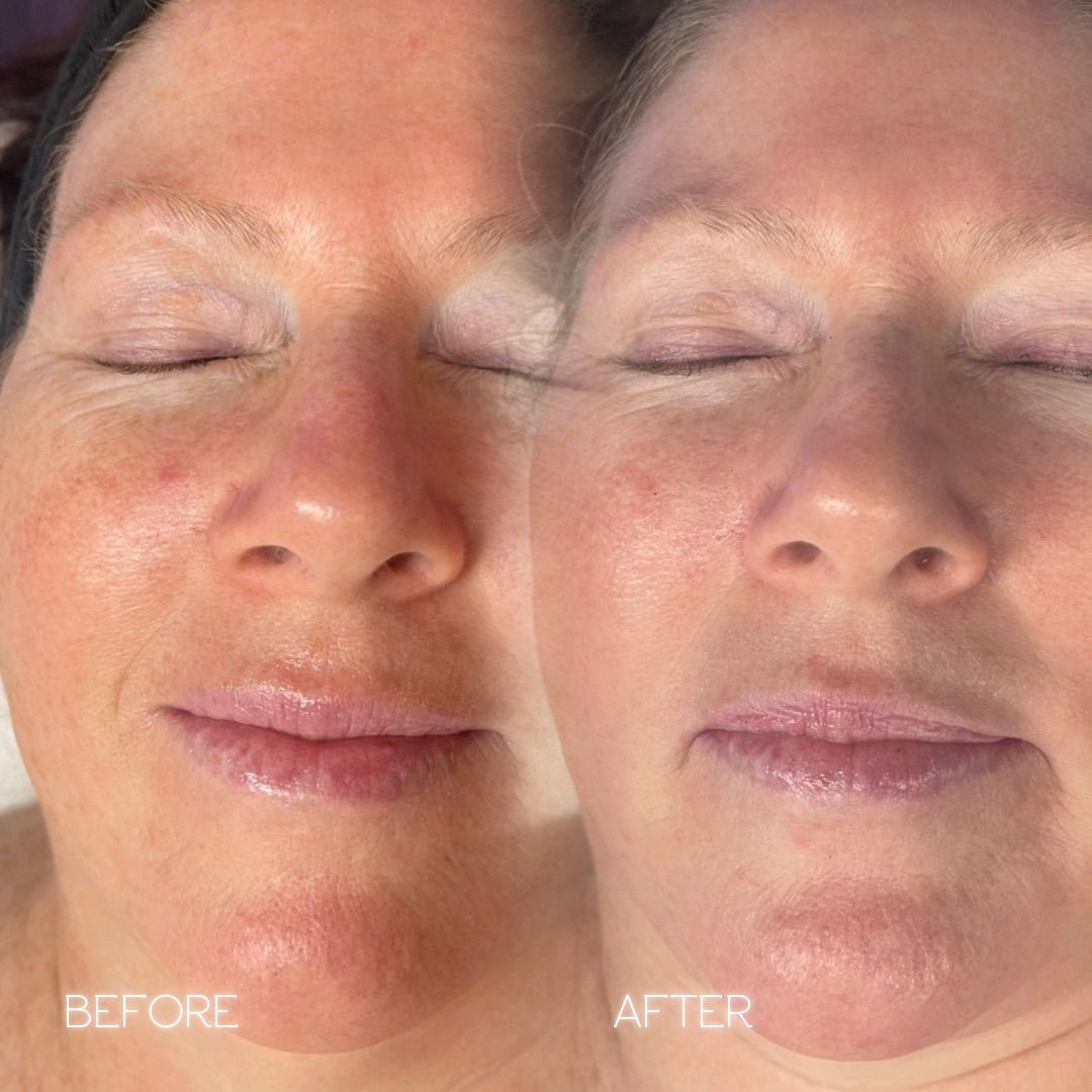 Customer photo review of Zena 100% Organic Algae Peel