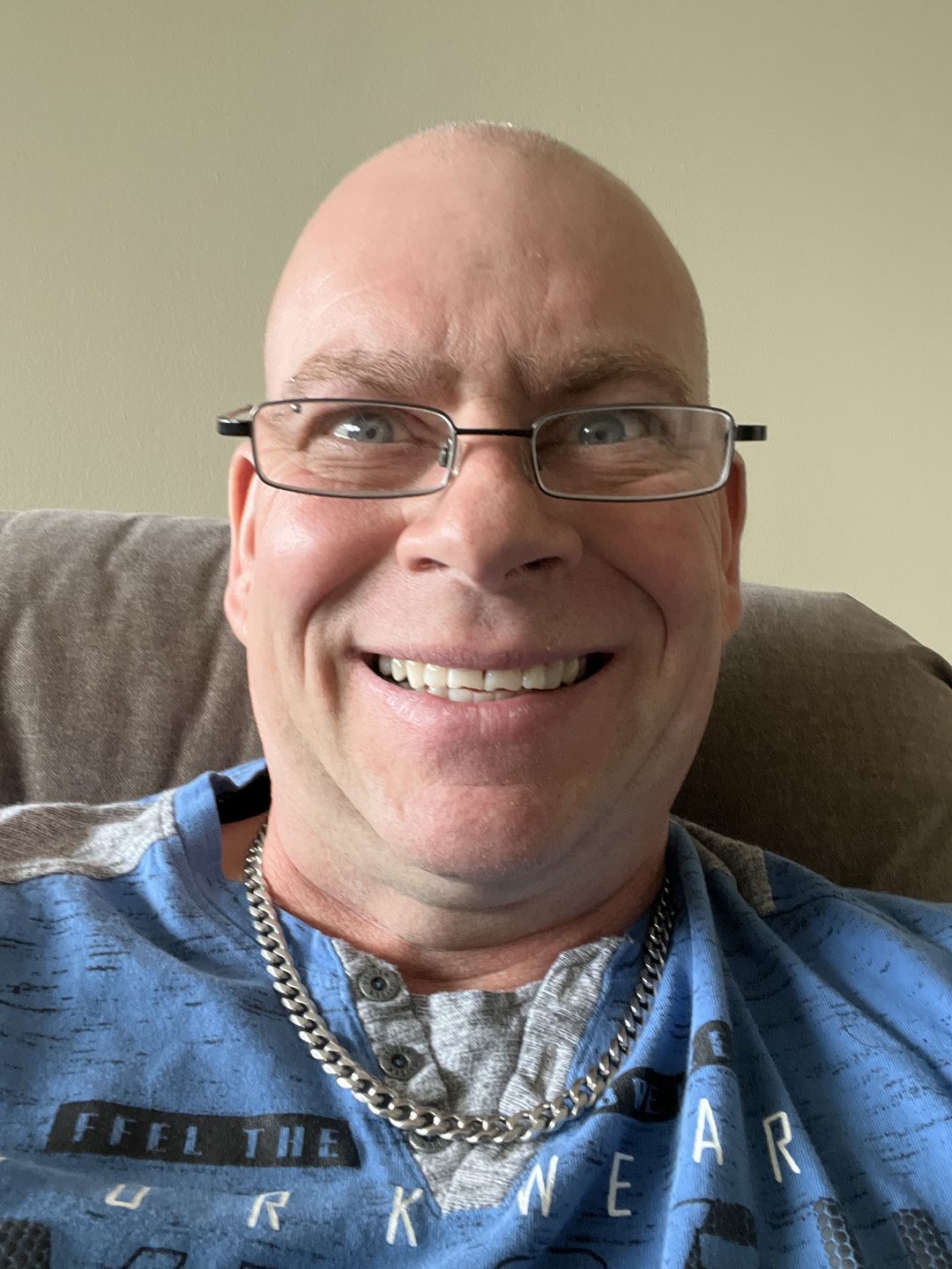 Customer photo review of Bandes Blanchissantes PAP (sans peroxyde)