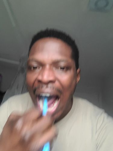 Customer photo review of Probiotic Tongue Coating Cleaning Gel with Scraper Mix Packs