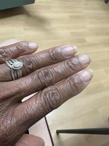 Customer photo review of The Nail System