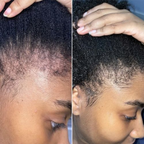 Customer photo review of Inches - Hair & Beard Oil