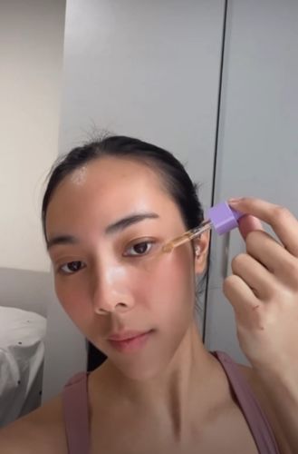 Customer photo review of Dark Circles Treatment