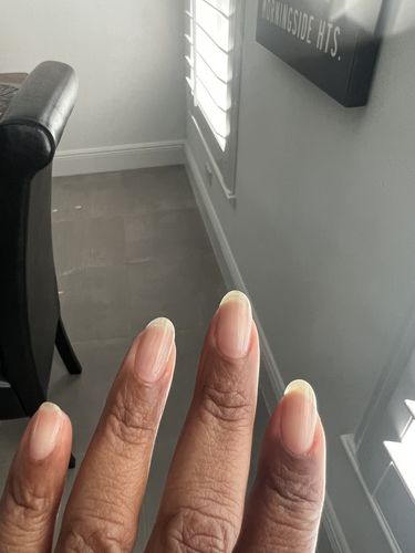 Customer photo review of Route Package Protection