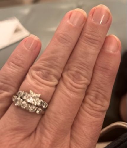 Customer photo review of The Nail System