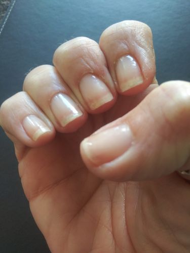 Customer photo review of Rocket Nail Fuel Nail Repair - Clear
