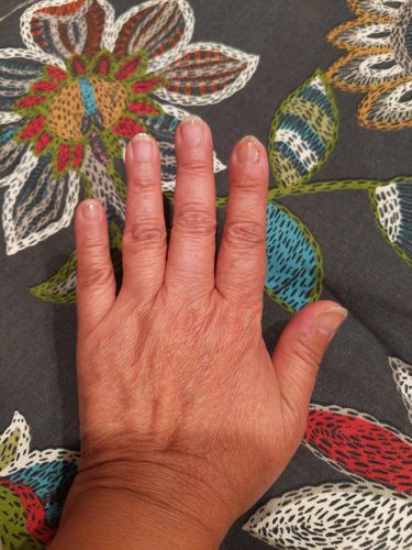 Customer photo review of Rocket Nail Fuel Nail Repair - Clear