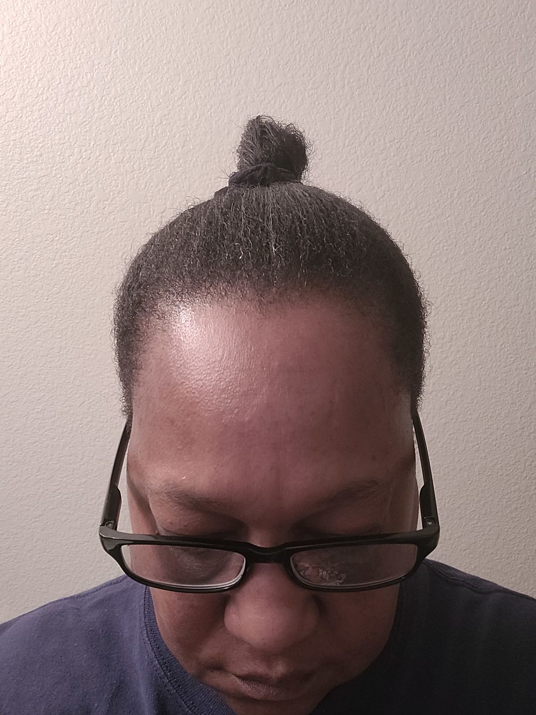Customer photo review of Omez miracle in a jar