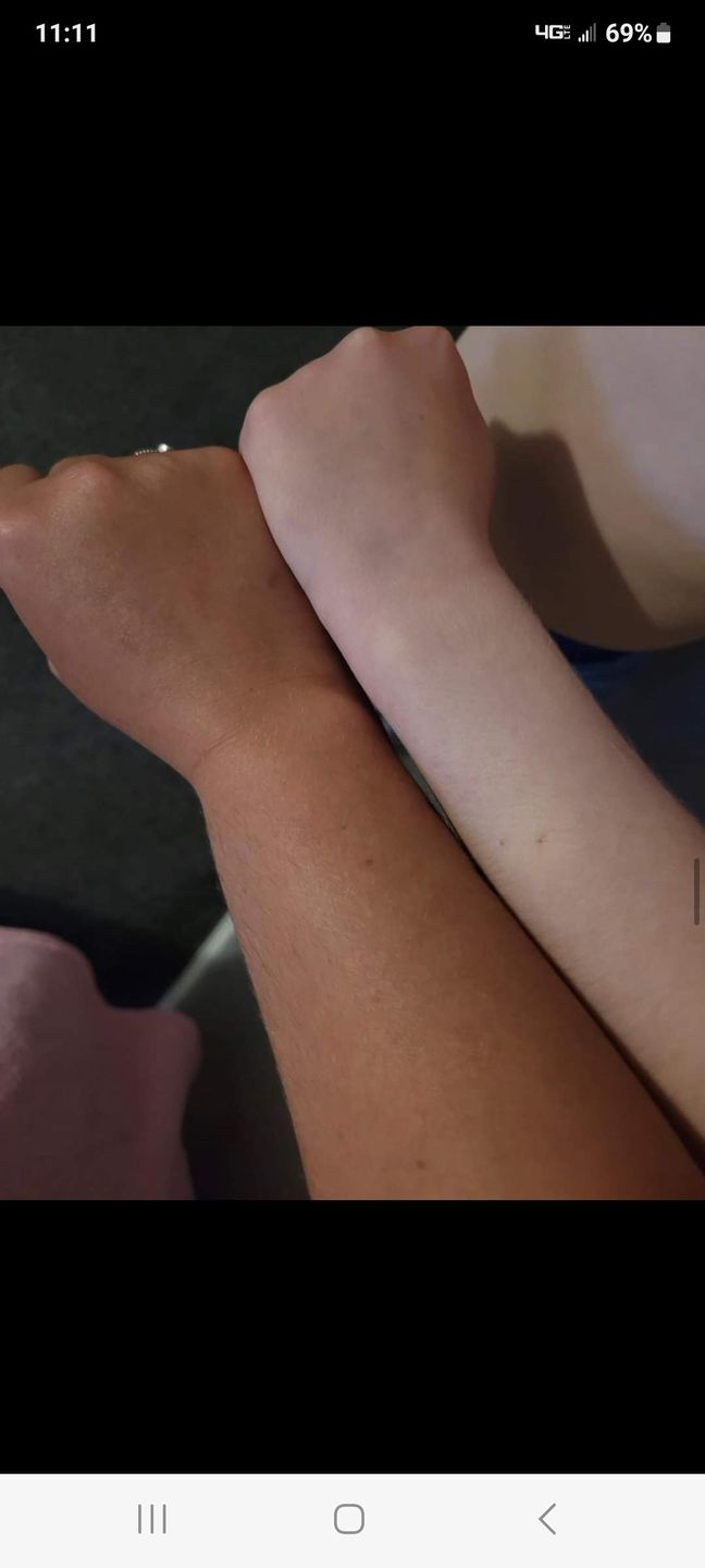 Customer photo review of Melanoboost Peptide Sun Tanning Lotion + Bronzing