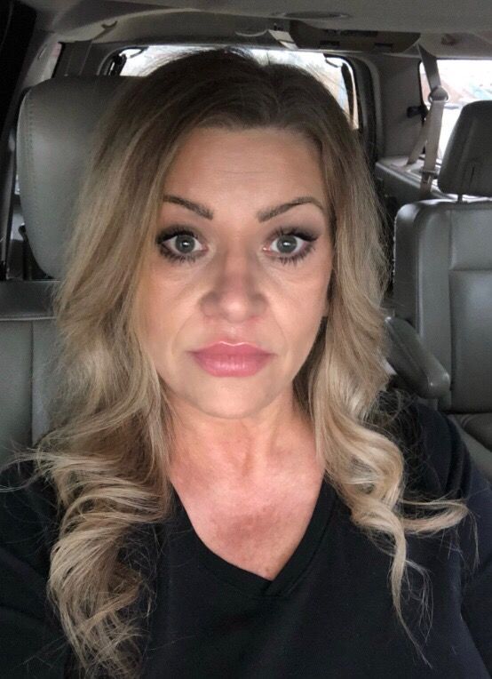 Customer photo review of 14% Jessner Skin Peel (5 ML) 🌿🍃🌱 Everything you need to do a skin peel! 🤩