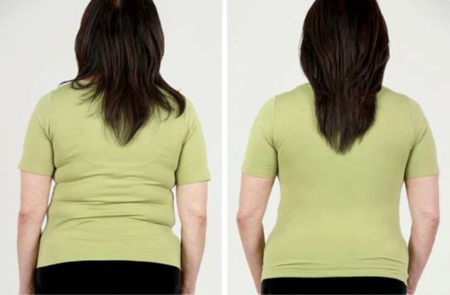 Customer photo review of Silvia - BH Anti Rücken- und Seitenfett