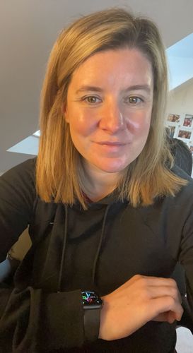 Customer photo review of Rosalique 3 in 1 Anti-Redness Miracle Formula SPF50