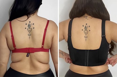 Customer photo review of Silvia - BH Anti Rücken- und Seitenfett